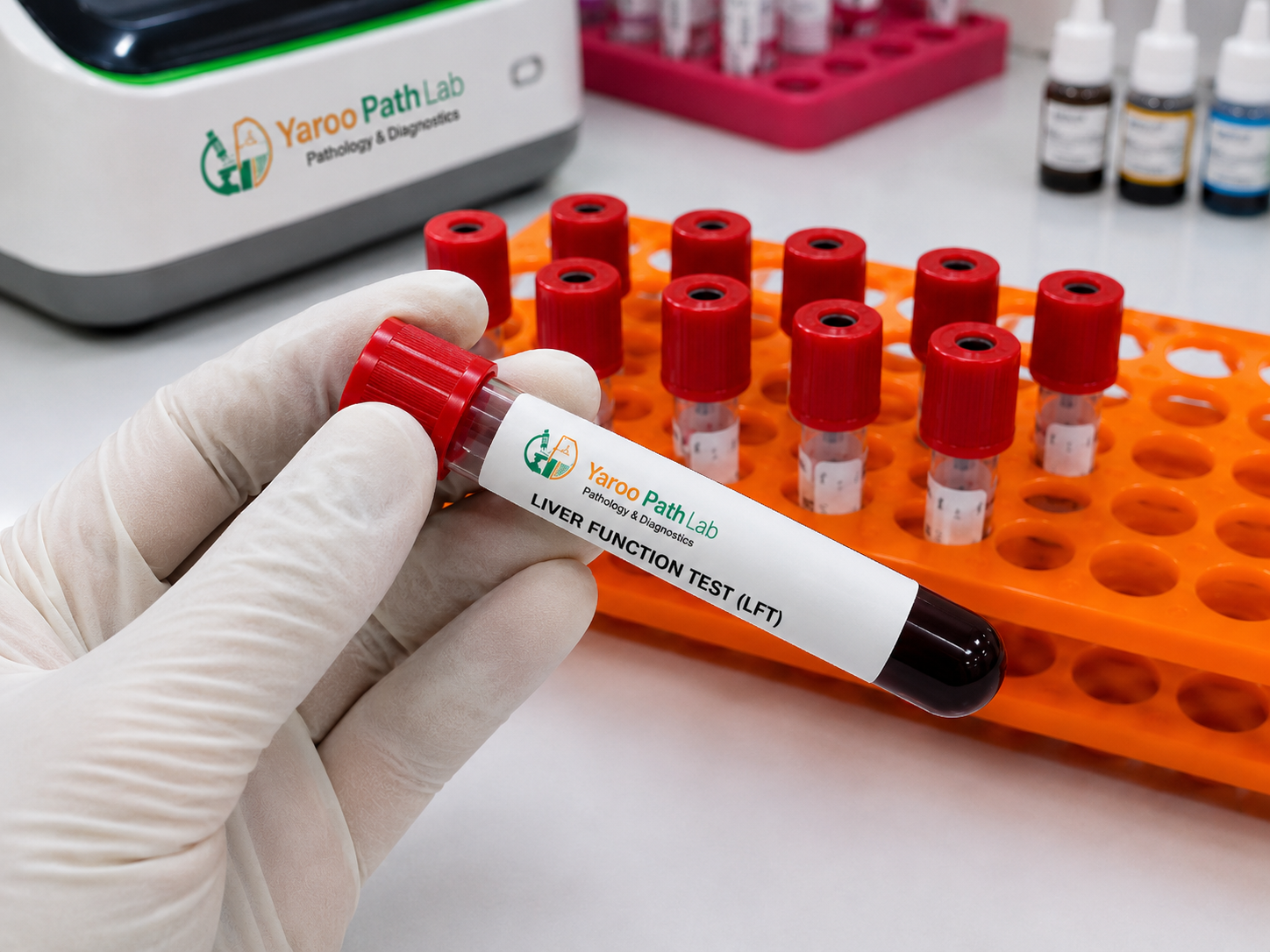 LIVER FUNCTION TEST (LFT)